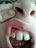 attached-photo