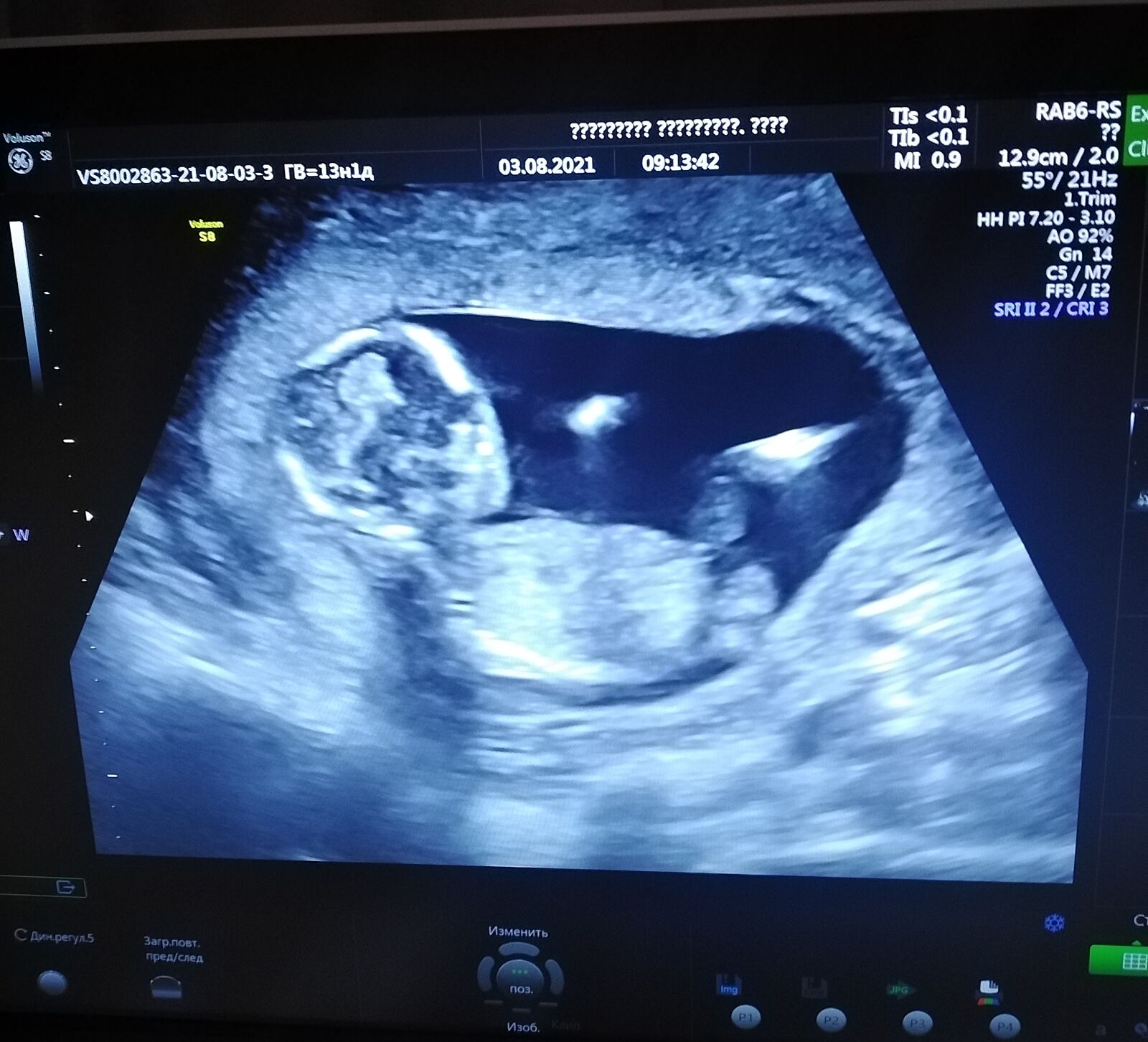 Фотография будущего ребёнка девочка или мальчик под вопросом. 37 недель мальчик
