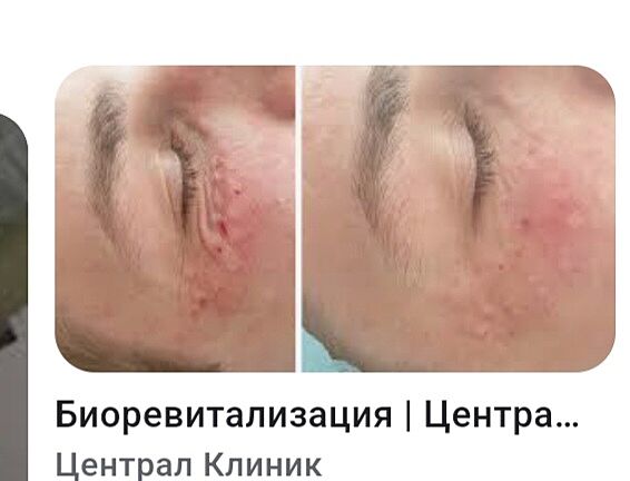 подскажите третиноин - Советчица