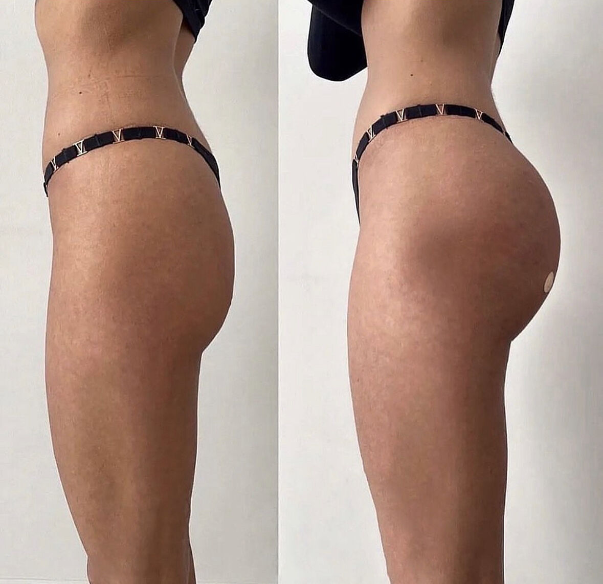 висящая пизда Обвисшая попа 38 лет - Советчица